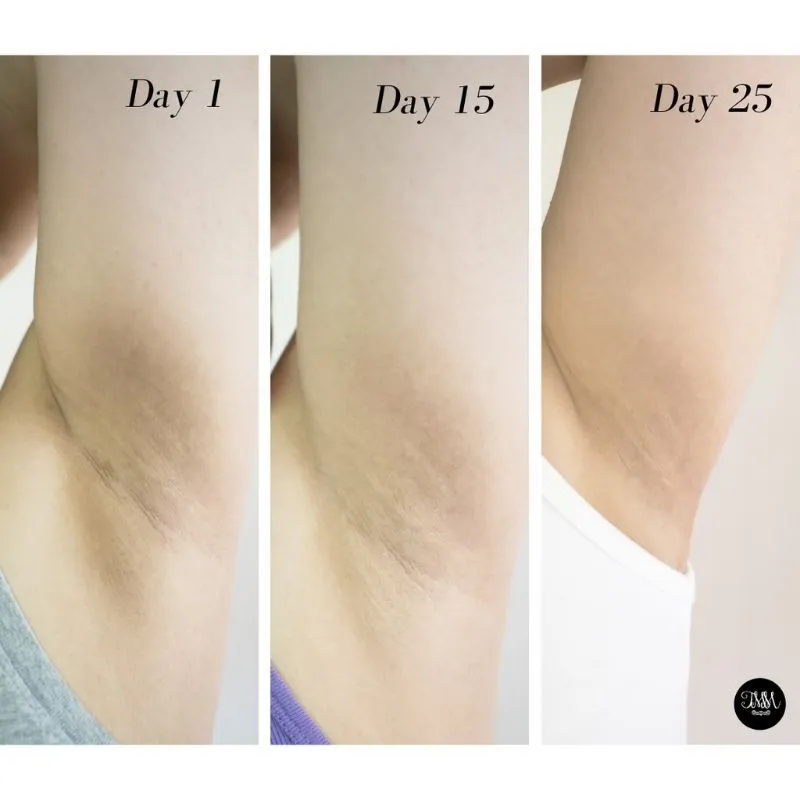 Underarm Bio Herbal 4-BioHerbal